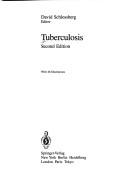 Cover of: Tuberculosis