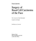 Cover of: Surgery of basal cell carcinoma of the face