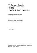 Cover of: Tuberculosis of the bones and joints