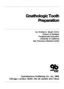 Cover of: Gnathologic tooth preparation