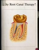 Cover of: Why root canal therapy? by Joel M. Berns