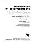 Fundamentals of tooth preparations for cast metal and porcelain restorations by Herbert T. Shillingburg