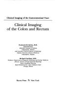 Cover of: Clinical imaging of the colon and rectum by Frederick M. Kelvin