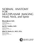 Cover of: Normal anatomy for multiplanar imaging: head, neck, and spine