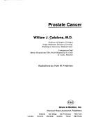 Cover of: Prostate cancer