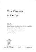 Viral diseases of the eye