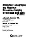 Cover of: Computed tomography and magnetic resonance imaging of the head and neck