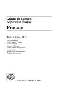 Cover of: Prostate