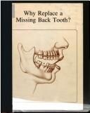 Cover of: Why replace a missing back tooth? by Joel M. Berns