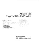 Cover of: Atlas of the peripheral ocular fundus | Jones, William L.