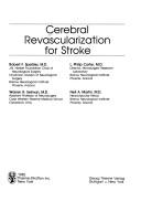 Cerebral revascularization for stroke