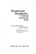 Cover of: Ectodermal dysplasias: a clinical and genetic study