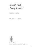 Cover of: Small cell lung cancer