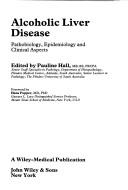 Cover of: Alcoholic liver disease: pathobiology, epidemiology, and clinical aspects