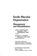 Cover of: Senile macular degeneration by Jan E. Lovie-Kitchin