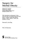 Cover of: Surgery for morbid obesity by John H. Linner