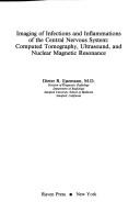 Cover of: Imaging of infections and inflammations of the central nervous system: computed tomography, ultrasound, and nuclear magnetic resonance