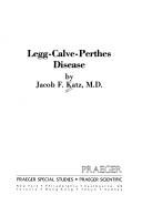 Cover of: Legg-Calve-Perthes disease by Jacob F. Katz