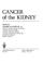 Cover of: Cancer of the kidney