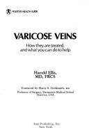 Cover of: Varicose veins: how they are treated and what you can do to help