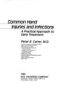 Cover of: Common hand injuries and infections by Peter R. Carter
