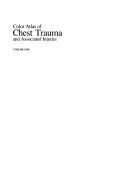 Color atlas of chest trauma and associated injuries