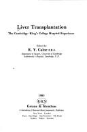 Cover of: Liver transplantation | 