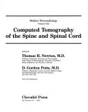 Cover of: Computed tomography of the spine and spinal cord by edited by Thomas H. Newton, D. Gordon Potts.