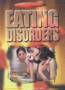 Eating disorders