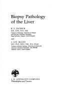 Cover of: Biopsy pathology of the liver