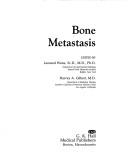 Cover of: Bone metastasis by edited by Leonard Weiss, Harvey A. Gilbert.