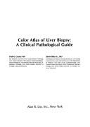 Cover of: Color atlas of liver biopsy: a clinical pathological guide