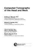 Cover of: Computed tomography of the head and neck