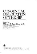 Cover of: Congenital dislocation of the hip