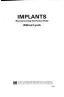 Implants by Wilfred Lynch
