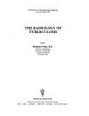 Cover of: The Radiology of tuberculosis by editor, Benjamin Felson.