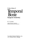 Cover of: Color atlas of temporal bone surgical anatomy