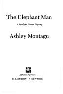 The elephant man by Ashley Montagu, Frederick Treves