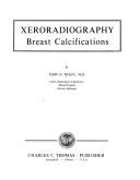 Cover of: Xeroradiography: breast calcifications