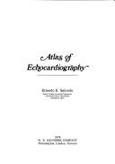 Cover of: Atlas of echocardiography | Ernesto E. Salcedo