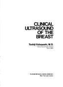 Clinical ultrasound of the breast by Toshiji Kobayashi