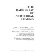 The radiology of vertebral trauma by John A. Gehweiler