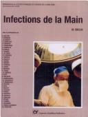 Cover of: Les Mutilations de la main