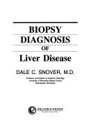 Cover of: Biopsy diagnosis of liver disease