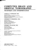 Computed brain and orbital tomography by Gonzalez, Carlos F.