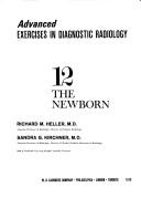 Cover of: Exercises in diagnostic radiology by [by] Lucy Frank Squire [and others]