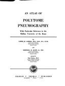 An atlas of polytome pneumography by Taher El Gammal