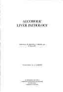 Cover of: Alcoholic liver pathology by edited by J. M. Khanna, Y. Israel and H. Kalant.