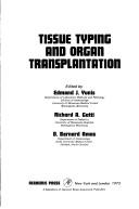 Cover of: Tissue typing and organ transplantation: proceedings.