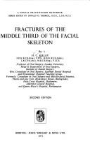 Cover of: Fractures of the middle third of the facial skeleton